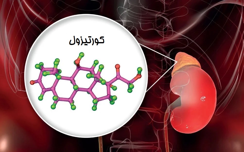 کورتیزول بالا 1