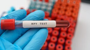 آزمایش HPV